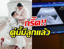 สิ้นสุดการรอคอย! คู่รักคู่นี้ มีลูกคนแรกสำเร็จแล้ว